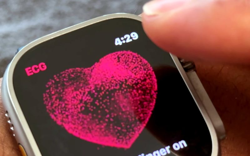 cum-functioneaza-detectarea-hipertensiunii,-afectiunea-secolului-la-nivel-global,-pe-ceasurile-inteligente-apple-watch-series-11-si-ultra-3