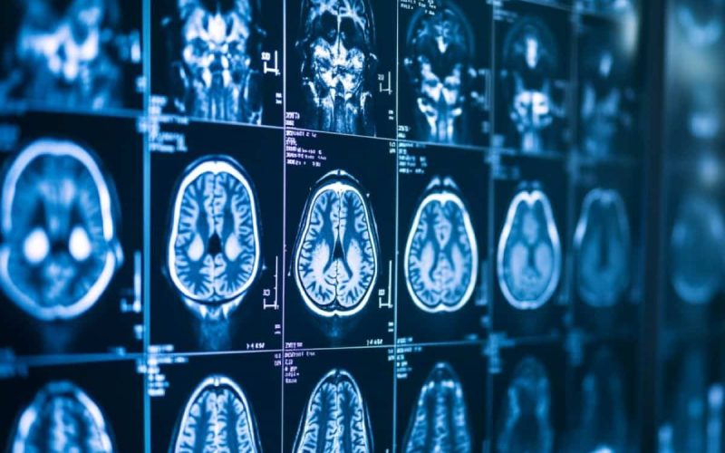 tehnologia-imersiva-care-ii-ajuta-pe-neurochirurgi-sa-salveze-vieti.-cum-schimba-realitatea-mixta-pregatirea-pentru-operatii