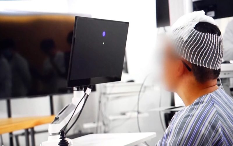 barbat-paralizat-isi-controleaza-scaunul-cu-rotile-si-gadgeturile-doar-cu-mintea,-la-cinci-zile-dupa-un-implant-cerebral-in-china
